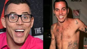 Steve-O'S Voice Isn'T Raspy Due To Substance Abuse, But Because He Talks  Through His Throat Muscles Instead Of His Vocal Cords. Here Is A Video Of  Him Practicing Talking Through Is Vocal
