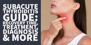 Image result for Thyroiditis