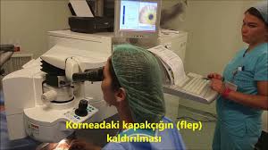 bugun isvicreli hastam minos basarili bir i lasik ameliyati ile gozluklerinden kurtuldu ilasik intralasik lasik lazer laser bilgi serum