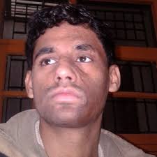 I was burnt by gunpowder 9 years ago. I'm 21 and still have the dark mark.  How can I fix it? (Photo)