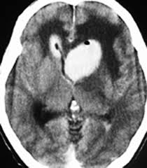 Последние твиты от ケイン・ヤリスギ「♂」 (@kein_yarisugi). ä¸­æž¢ç¥žçµŒåŽŸç™ºãƒªãƒ³ãƒ'è…« Pcnsl è„³å¤–ç§'åŒ» æ¾¤æ'è±Šã®ãƒ›ãƒ¼ãƒ ãƒšãƒ¼ã‚¸