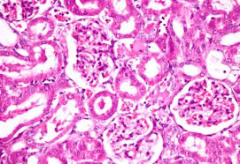 Control group: kidneys showing normal glomeruli and renal tubules