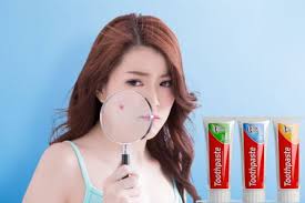 11 Tips Cara Menghilangkan Jerawat Dengan Pasta Gigi Bisnismana Com
