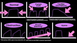 In case of the bip39 application, you can paste it into the bip39 mnemonic field to use it as a new mnemonic. Umem Educational Pearls University Of Maryland School Of Medicine Department Of Emergency Medicine