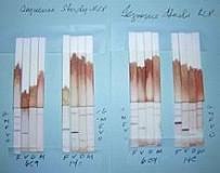 Image result for Malaria Parasite Antigen Test