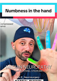 Image result for karp ln  tunel ort za