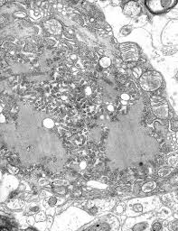 Mrna vaccine candidates can take advantage of many innovations developed in the last few decades that increase rna stability and increase translation efficiency in cells. Mrna The Future Of Vaccines
