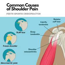 Shoulder pain is relatively common and has a variety of causes, ranging from a simple muscle pull to a dislocated joint. Shoulder Pain Perth Sports Chiropractor Inglewood Mount Lawley Wa Formerly In Bassendean