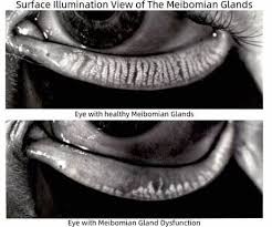 Image result for Blepharis sol