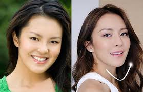 Kelly Cheung Accused of Plastic Surgery Before and after photos of  “Forensic Heroes 4” star, #KellyCheung, surface  https://www.jaynestars.com/news/kelly-cheung-accused-of-plastic-surgery/