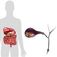 I've been feeling better so far and plan to do another one soon. Symptoms Causes Of Gallstones Niddk