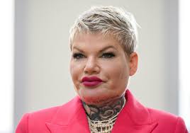 Dschungelkönigin Melanie Müller: So krass hat sie sich verändert