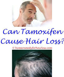 Coupons For Hair Loss How To Prevent Hair Loss In Young Males Causes Sudden Rapid Hair Loss Hair Loss On Dogs Lower Back Does Methotrexa Prevent Hair Loss Stop Hair Loss
