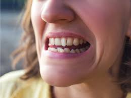 Can braces fix jaw alignment? Orthodontic Relapse And Skeletal Problems With Tmj Airway And Sleep Group