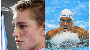 Una nella gara di fioretto individuale e una in quella a squadre. Tokyo Bebe Vio E Federico Morlacchi Portabandiera Alle Paralimpiadi La Repubblica