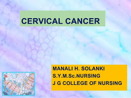 Cervical cancer affects the entrance to the uterus. Cervical Cancer Ppt