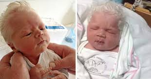 Surprised that you have started greying so early when your parents & grabdparents greyed much, much later? Baby Born With Full Head Of Gray Hair Wins The Hearts Of All Around Him