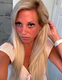 Help with hair loss and wig options in Peachtree Corners