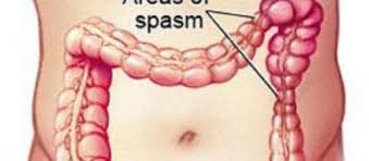 Vanno molto bene gli acidi grassi, come frutta secca, l'avocado ed il pesce come il salmone. Dieta Per Intestino Irritabile Dott Prof Antonio Iannetti