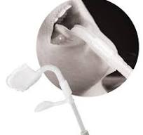 Lingua-Fix Saliva Ejector | Zirc | DPS