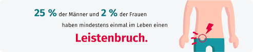 Hernien sind innere brüche im körper. Hernien Ursachen Behandlung Vorbeugung Gesund Bund De