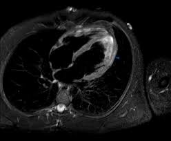 J magn reson imaging 2007; Experts Raise Questions Over Scary Covid Heart Studies