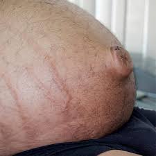 Maybe you would like to learn more about one of these? The Stages Of Liver Disease American Liver Foundation