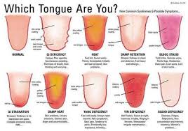 Proudly Featured In Gnc Www Deerantlerspray Com Is Not A Drug It Is A Supplement In Chinese Medicine The Antlers A Alternative Health Body Health Body Hacks