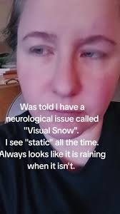 Disease Where You Can See Static from Tv