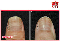 Image result for Mees Line