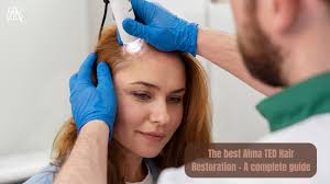 THE BEST ALMA TED HAIR RESTORATION