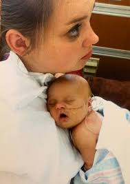 It's Down Syndrome Awareness Month. Here's What You Should Know.