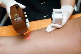 For laser hair removal and laser tattoo removal, the cost is $3,500 each while that of laser skin rejuvenation, it is $3,800. Certified Laser Technician Education Requirements