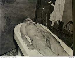 Wikimedia commons a macabre autopsy photo of mussolini and his mistress in a milan morgue. Italy C 1945 04 28 Naked Corpse Of The Italian Fascist Leader Benito Mussolini On A Slab In Australian War Memorial