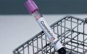 Is India running too few coronavirus tests? - The Hindu BusinessLine