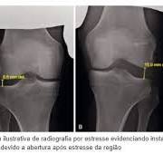 Dr Diego Munhoz Especialista em Joelho