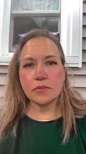 Eamon Flaherty Injured