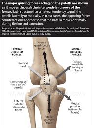 Ocd may also happen in the knee or elbow in some patients. Surgery And Non Surgical Treatments For Chronic Knee Cap Dislocation And Patella Instability Caring Medical Florida