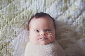 If you notice a bulging on one side or any other severe changes to your baby's head shape, your doctor can help. This Baby Girl Has An Inoperable Brain Tumor So Her Parents Did A Photoshoot To Show Their Love Bored Panda
