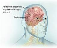 Image result