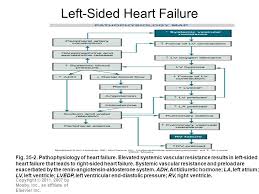 Heart Failure The Most Common Reason For Hospitalization In