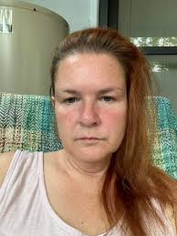 They took so much blood from me ,I can still feel the needle going into my  skin smh