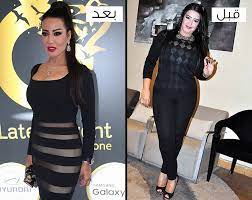 كم يحتاج لاعب كمال الأجسام من السعرات الحرارية. ØªØºÙŠ Ø±Ø§Øª Ø¥Ø·Ù„Ø§Ù„Ø§Øª Ø§Ù„Ù†Ø¬Ù…Ø§Øª Ù‚Ø¨Ù„ ÙˆØ¨Ø¹Ø¯ Ø®Ø³Ø§Ø±Ø© Ø§Ù„ÙˆØ²Ù†