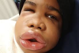 Fundraiser by Samantha Russell : Team Tarique Fighting Against H.A.E