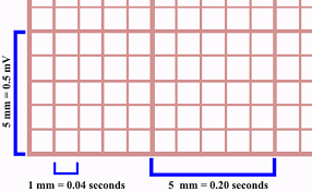 Electrocardiogram Paper