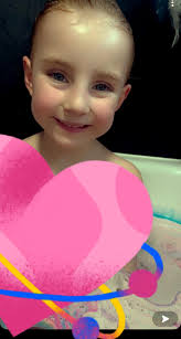 Why all I see in my fyp is,when In there head theres a red hair something  like that🫨