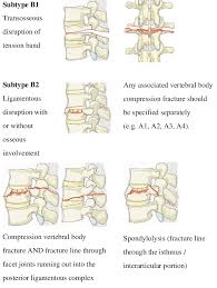 6 easy to use 7 take in 8 defeated 9 different forms 10 modify. Type B Tension Band Injuries Download Scientific Diagram