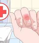 Cactus fruit is a part of the skag dog days mission in borderlands 3, where you have to find five locations of red cacti and harvest their fruit. 3 Ways To Remove Cactus Needles Wikihow