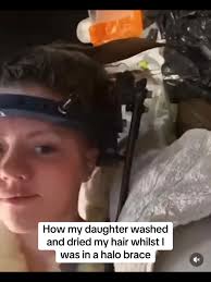 My weekly treat 😂 so much effort. She done amazing. #halo #halobrace  #brace #spinalfusion #scoliosis #kyphosis #fyp #hair #hairwash #glowup