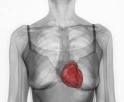 The significance of the coronary calcium score (cs) as to its correlation to coronary artery disease (cad) has been well studied, however, its significance in adding information to asymptomatic high risk patients with negative stress test has not been investigated. Le Score Calcique Coronaire Fait Encore Mieux Chez Les Femmes Le Quotidien Du Medecin